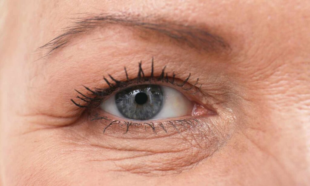 especialista en blefaroplastia Cd Juarez