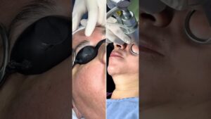 A2fL547KNY HD