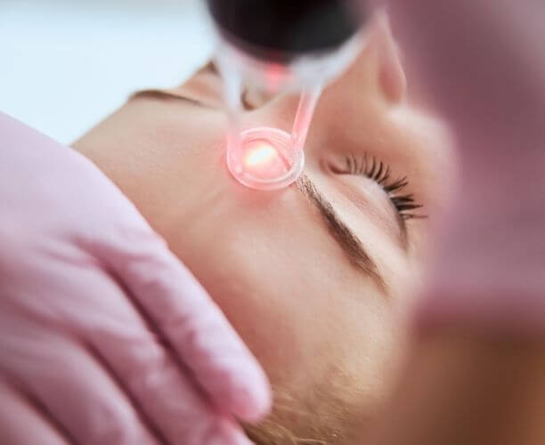 Rejuvenecimiento facial laser Juarez