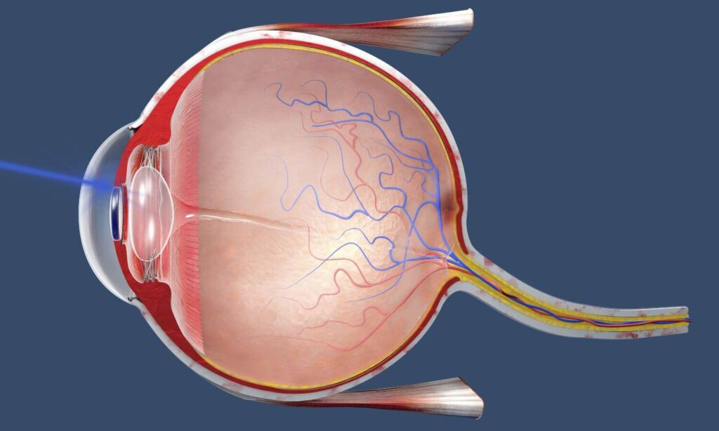 operacion de ojos Cd. Juarez